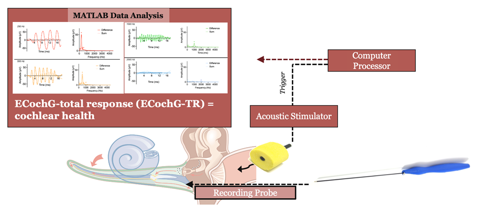 Figure 4: Procedure for Measuring ECochG-Total Response (ECochG-TR) to Assess Cochlear Function. The relationship between cochlear function and CI performance is studied using electrocochleography (ECochG). The ECochG measurement process involves inserting a foam tip in the ear canal and playing acoustic stimuli to elicit electrophysiologic responses from the cochlea. These responses are measured on the round window using a sterile monopolar recording probe before array insertion. MATLAB is used to process the data to quantify neural and hair cell responses. The ECochG-Total Response (ECochG-TR) score is calculated by summing responses to tonal stimuli across the speech spectrum, providing a representative indicator of cochlear health.