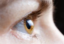 Macro photo of the human eye with corneal disease keratoconus