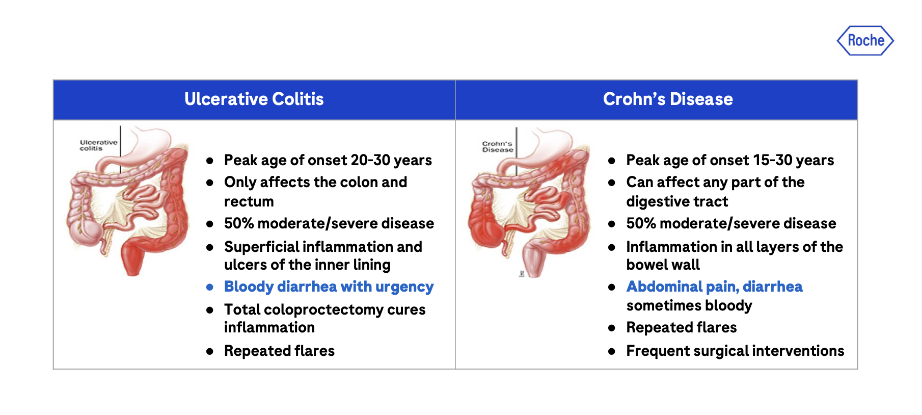 Figure 1: Similarities and differences of Ulcerative Colitis and Crohn’s Disease