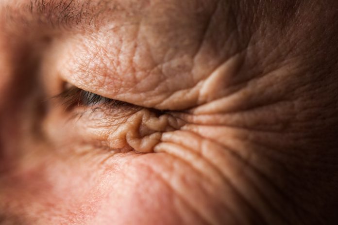 Understanding skin ageing: Taking care of your skin