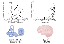 Figure 1: Electrocochleography-total response (ECochG-TR) measured at the round window prior to cochlear implant insertion (RW-ECochG-TR) shows a weak correlation with performance in noise (AzBio +10 dB signal-to-noise ratio). Similarly, the MoCA score, a measure of cognitive function, also exhibits a weak correlation with performance in noise. However, a multivariate model incorporating both cochlear health (ECochG-TR), cognition (MoCA score), and their interaction (product of ECochG-TR and MoCA) explains 46.0% of the variability in noise performance. This finding suggests that while good cochlear health is necessary for strong performance in noise, it is not sufficient on its own – it must be complemented by adequate cognitive function.