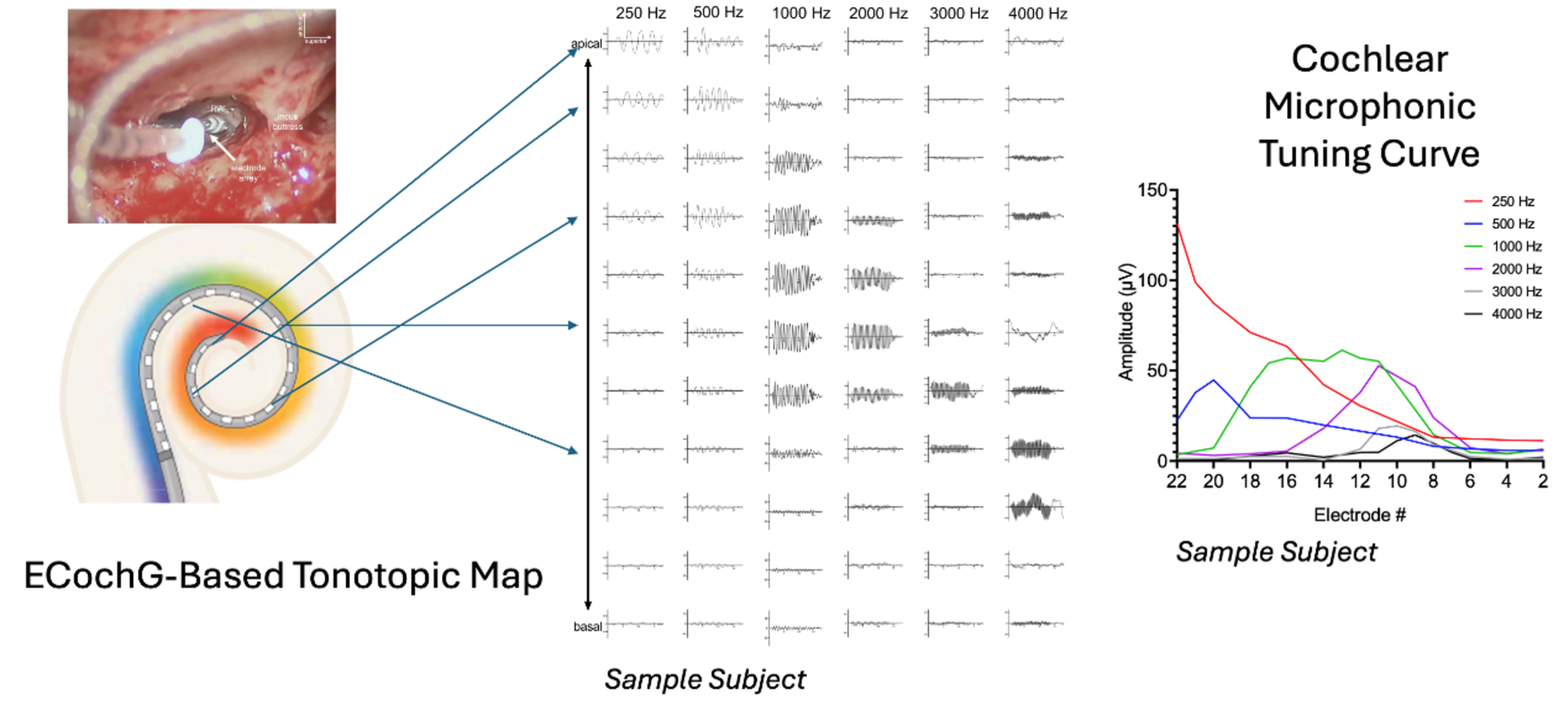 Figure 2: Electrocochleography-based mapping utilizing intracochlear electrocochleography, where the implant electrode measures acoustically- evoked responses across the electrode contacts. The cochlear microphonic response amplitude, analyzed through fast Fourier transformation, is shown for a sample subject, revealing the tonotopic arrangement of the cochlea. This information can then be used to develop a personalized cochlear implant mapping strategy tailored to the patient’s unique electrophysiologic responses.