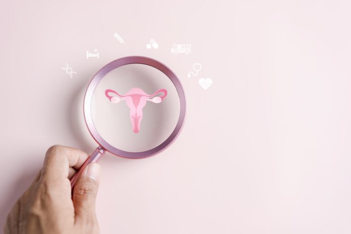 Checkup uterus, female reproductive system, women's health, PCOS, ovary gynecologic and cervical cancer, Healthy feminine concept