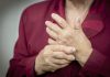 Hands Of Woman Deformed From Rheumatoid Arthritis. PainRheumatoid arthritis hands. MacroRheumatoid arthritis hands. Macro