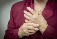 Hands Of Woman Deformed From Rheumatoid Arthritis. PainRheumatoid arthritis hands. MacroRheumatoid arthritis hands. Macro