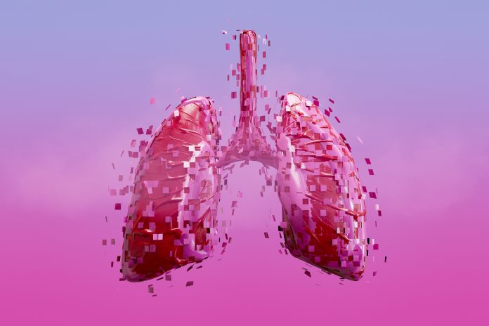 Dissolving human lung. Lung health. Smoking issues. Digitally generated image. 3d render.