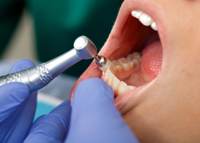 Close up of a professional dental brushing at the clinic