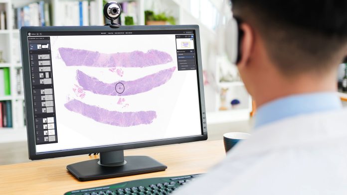 Reimagining diagnostics: Why ai is essential for the future of NHS pathology