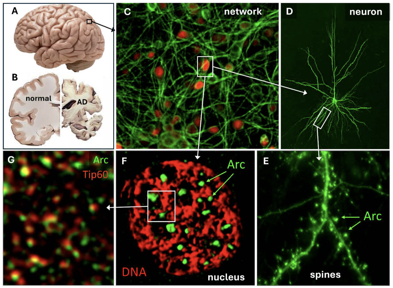 Figure 1. Structures implicated in memory. A. The human brain. B. Cross-section of a postmortem normal brain (left) and a brain from a severe AD patient. C. Network of neurons growing in tissue culture. Green is a neuronal marker; red is Arc protein. D. A single neuron from a brain region called the hippocampus that has been fluorescently labeled. Note the many neurites emanating from the cell body, called ‘dendrites’. This is where the incoming information from other neurons is processed. E. A segment of a dendrite is shown in more detail. The dendrite is decorated with small protrusions called ‘spines’, where synaptic connections between neurons are made. Arc (in green) is enriched in the spines, where it regulates synaptic function. Note the different sizes of the spines, which show plasticity: they can change their size and efficacy. F. A slice of a neuronal nucleus is shown with the DNA in magenta and Arc protein in green. Arc is assembled into small clusters (puncta) closely associated with genomic DNA. G. DNA inside the nucleus is organized into protein-DNA structures called ‘chromatin,’ which is either tightly or loosely packaged. Arc (green) is closely associated with Tip60 (red), which can loosen chromatin to enable gene transcription.