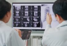 Medical team Asian male and female doctors medical checking x-ray image of patient on computer discussing result meeting in hospital. Medical health care.