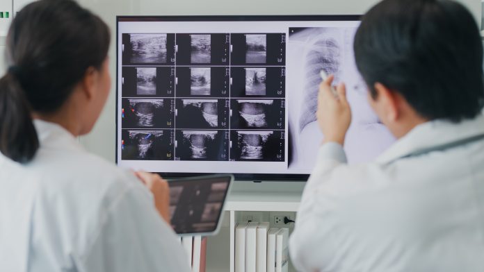 Medical team Asian male and female doctors medical checking x-ray image of patient on computer discussing result meeting in hospital. Medical health care.