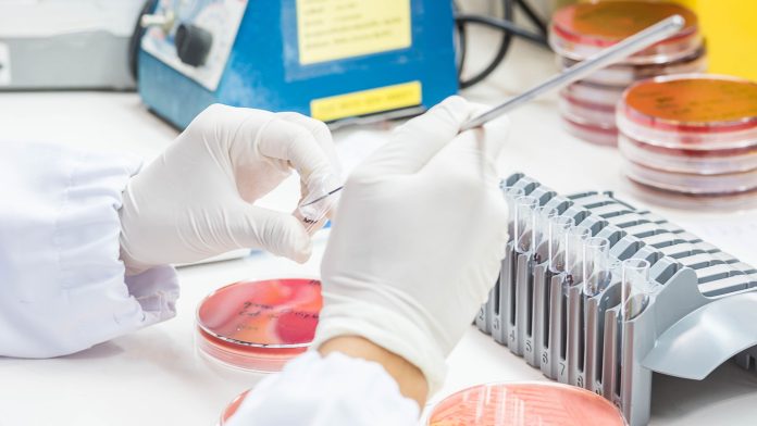 Close up on hand medical technicians working on bacterial culture and drug resistance of pathogens in laboratory.