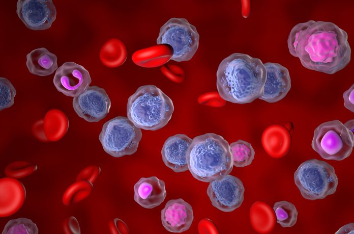 Acute myeloid leukaemia (AML) - isometric view 3d illustration