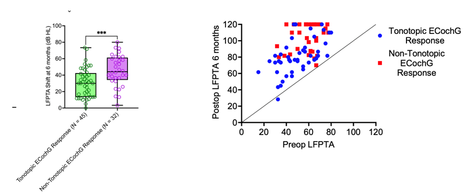 Figure 3: A tonotopic EcochG response is associated with improved hearing preservation, which facilitates the effective use of hybrid stimulation strategies and leads to improved performance in noise.